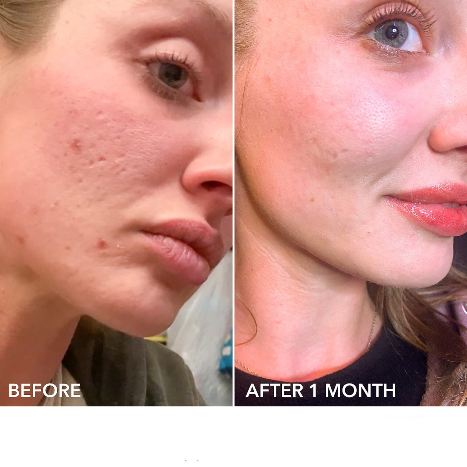 ALPHA BETA EXTRA STRENGTH DAILY PEEL  (ALMOHADILLAS EXFOLIANTES DIARIAS EXTRAFUERTES)